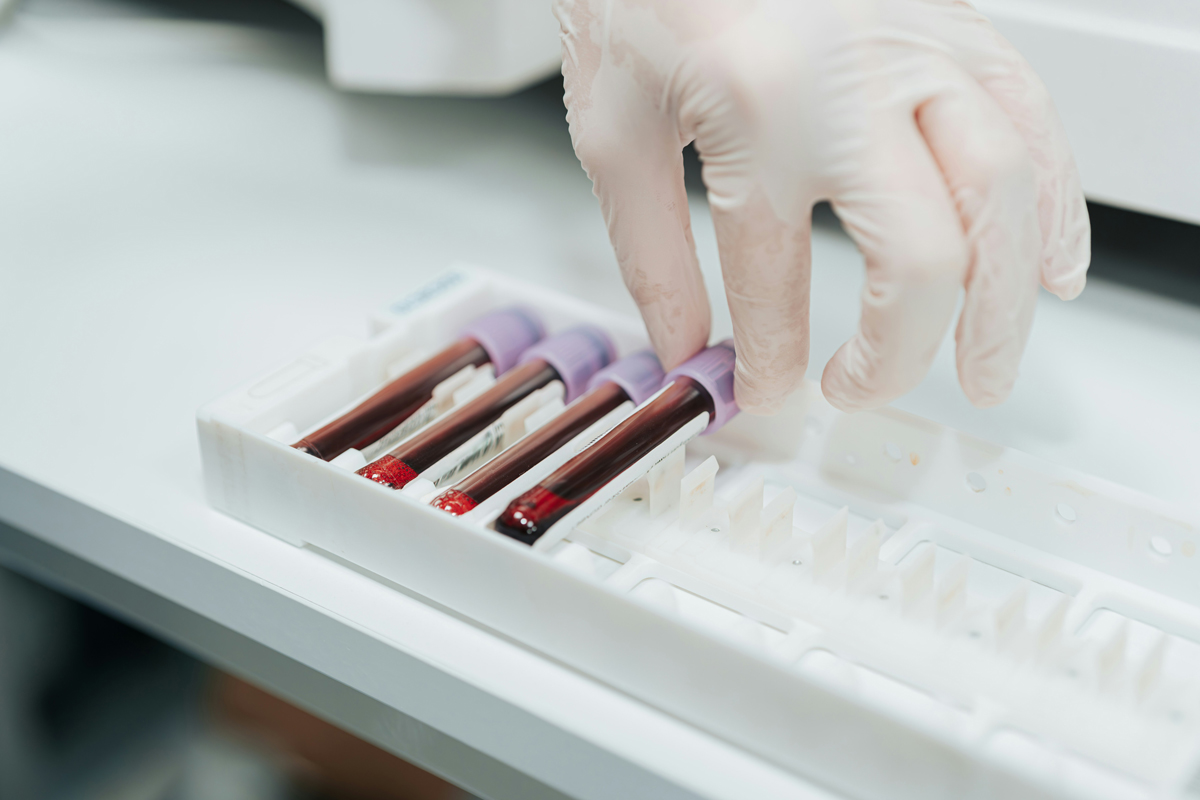 Test tubes of blood