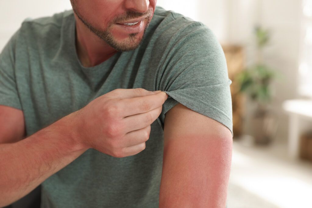 Person checking tanlines on their arm