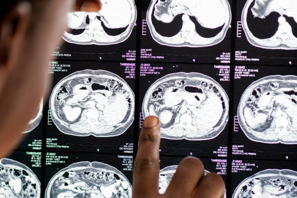 Brain scans