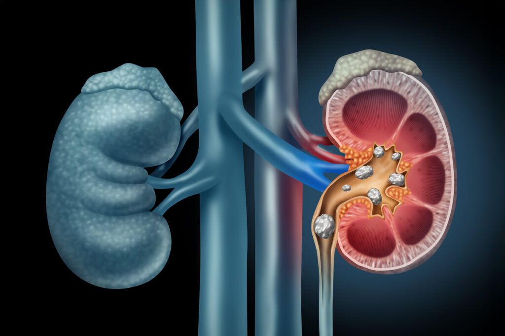 Diagram of human kidneys