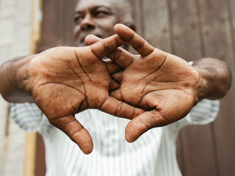Why Does Cracking Your Knuckles Feel So Good?