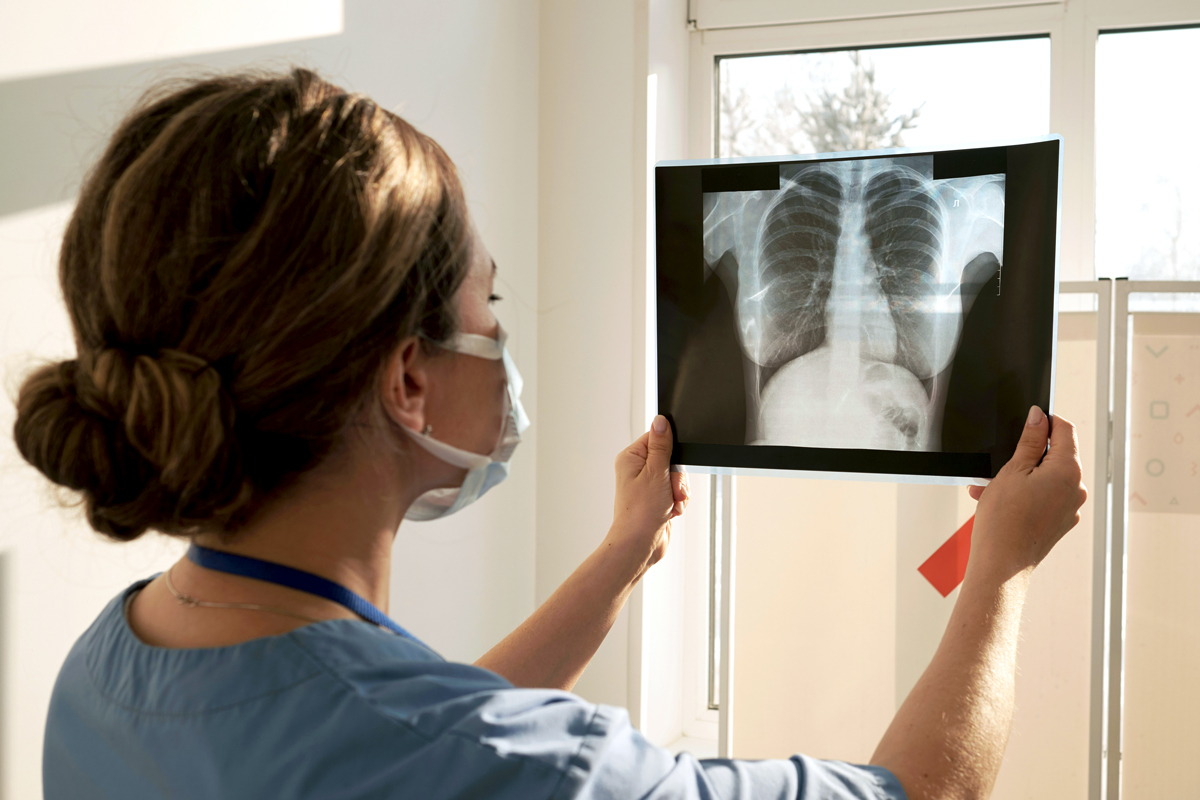 Doctor looking at an X-ray