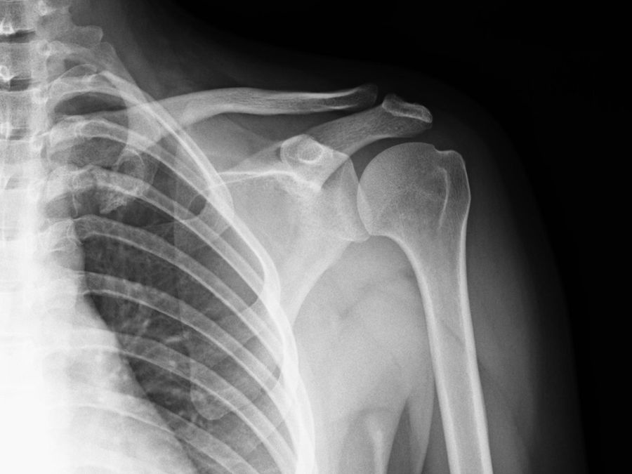 The 8 Weakest Bones in Your Body