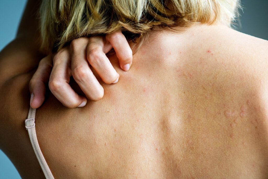 Person scratching their shoulder