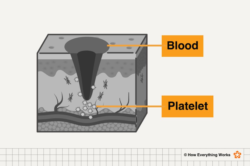 Diagram of bleeding cut