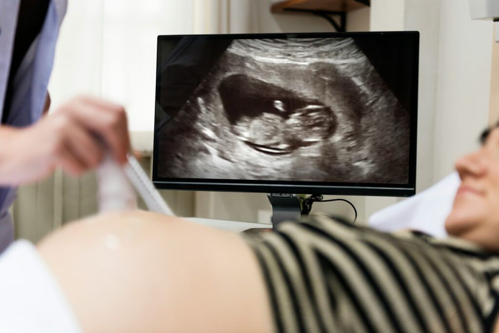 Ultrasound of fetus