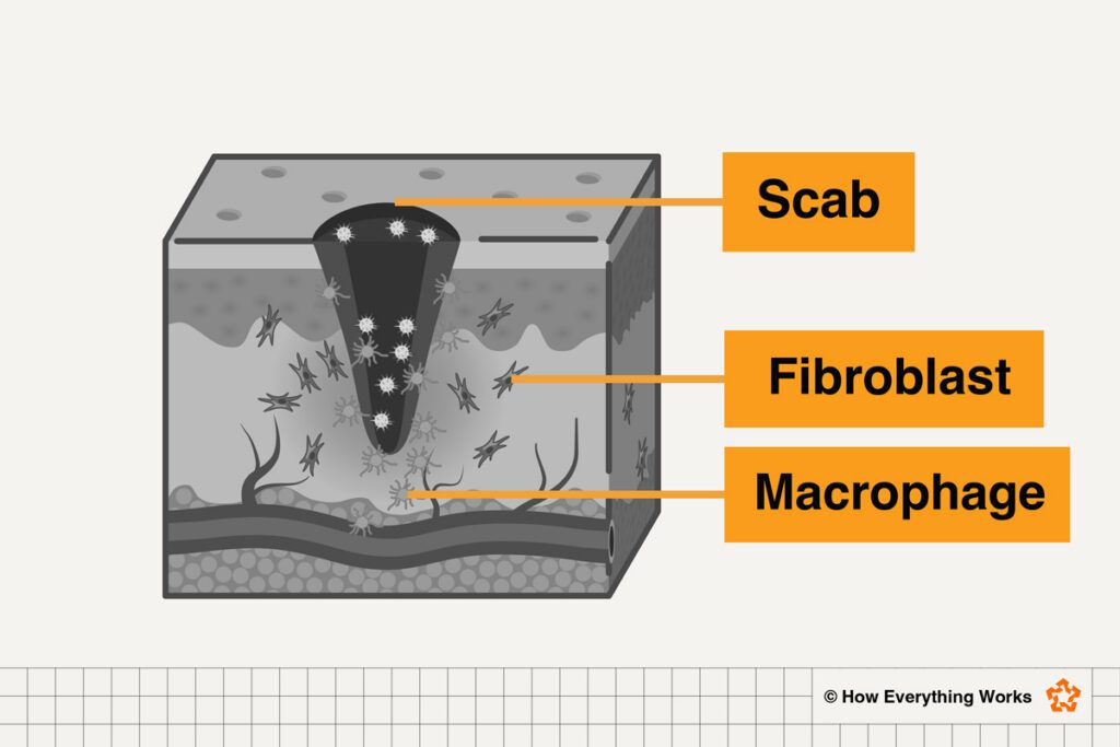 Diagram of inflammation as a cut heals