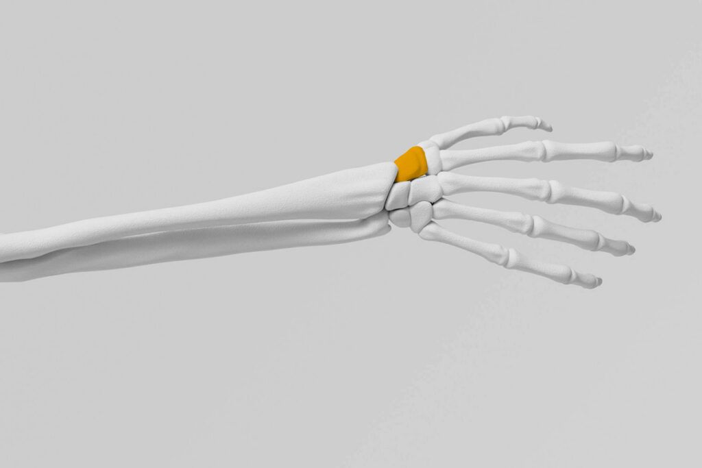 Scaphoid highlighted in X-ray