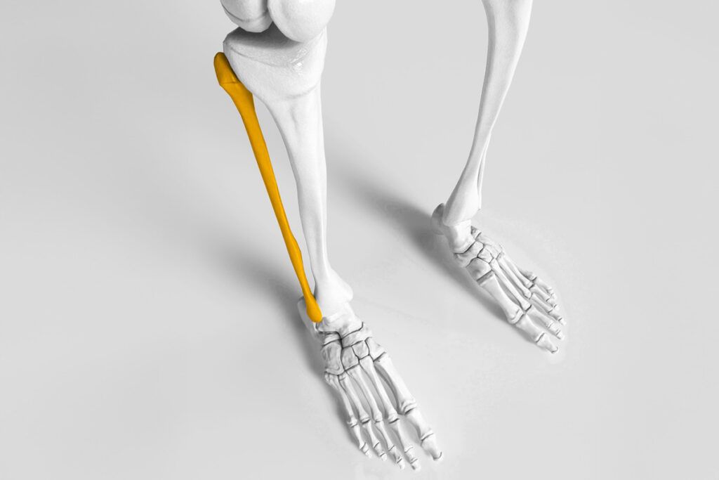 Fibula highlighted in X-ray