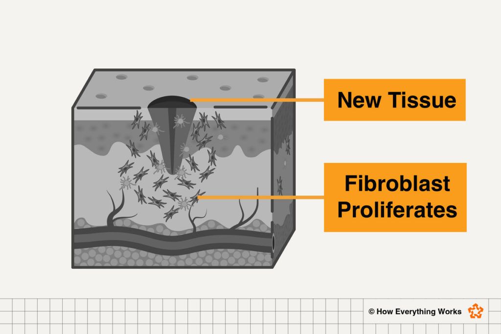 Diagram of new tissue growing as a cut heals