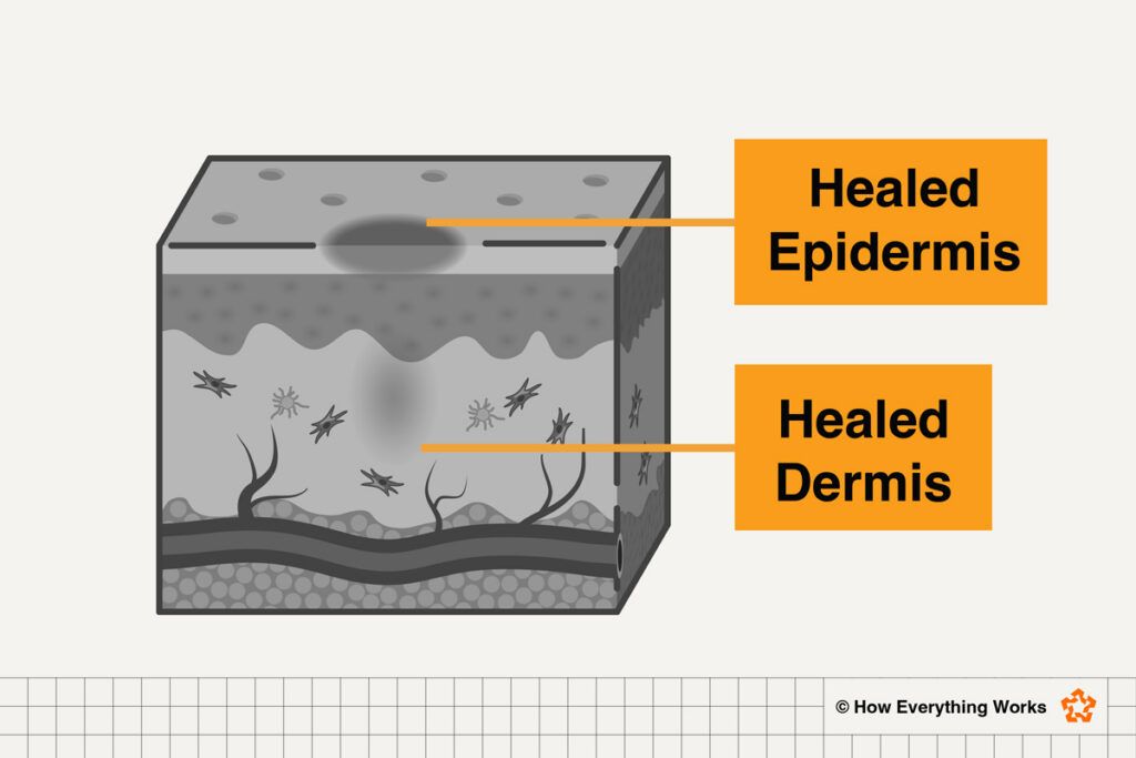 Diagram of scarring as a cut heals