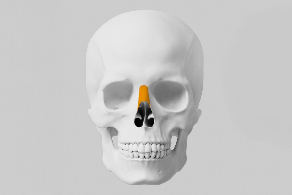 Nasal bone highlighted in X-ray