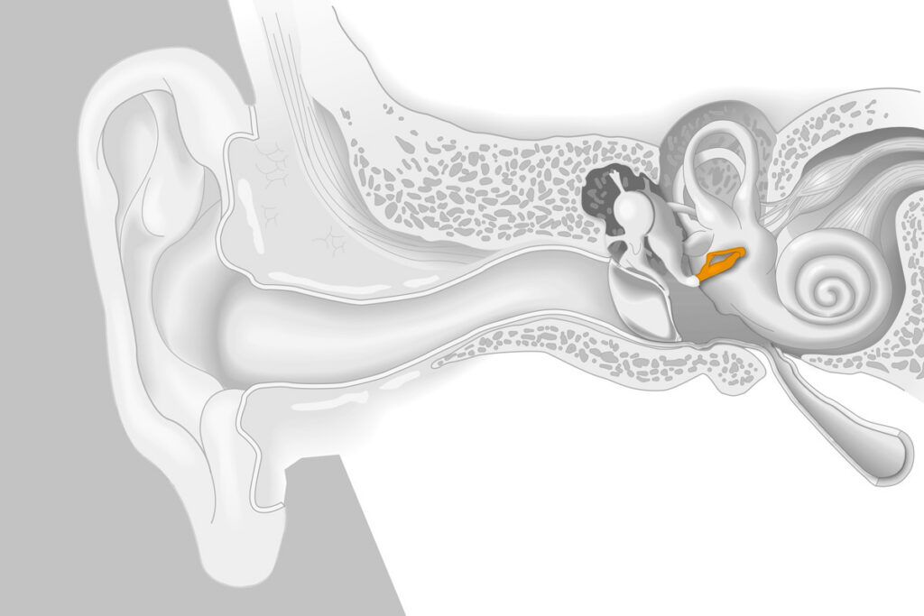 Stapes highlighted in X-ray