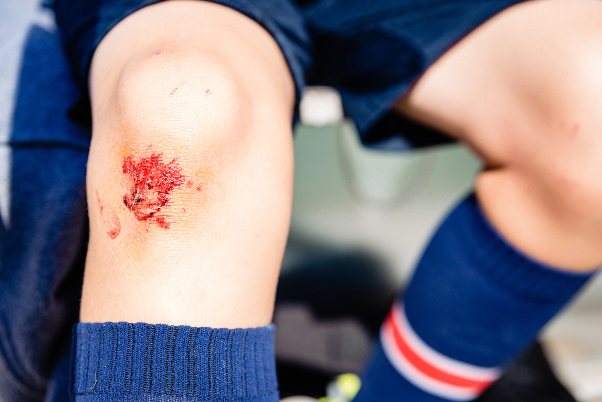 Minor abrasion on knee