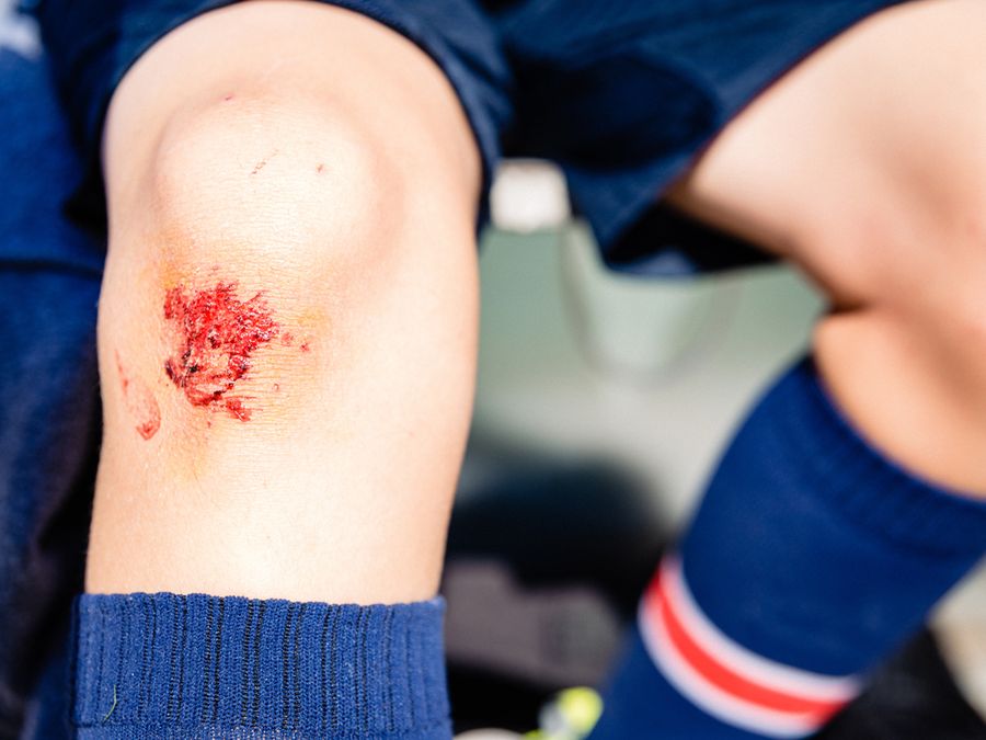 How a Cut Heals Itself, Step by Step